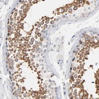 Anti-IFT43 Antibody