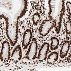 Immunohistochemical staining of human small intestine shows strong nuclear positivity in glandular cells.