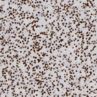 Immunohistochemical staining of human pancreas shows strong nuclear positivity in exocrine glandular cells.