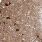 Anti-STXBP6 Antibody