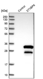 Anti-STXBP6 Antibody