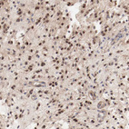 Anti-MAGED4B Antibody