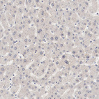 Anti-MAGED4B Antibody