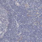 Anti-MAGED4B Antibody