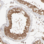 Anti-SCFD1 Antibody