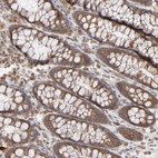 Anti-SCFD1 Antibody