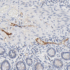 Immunohistochemical staining of human small intestine shows strong positivity in plasma.