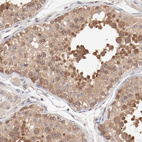 Anti-SETD3 Antibody