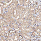 Anti-SETD3 Antibody