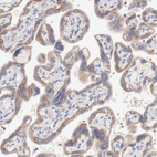 Anti-SETD3 Antibody