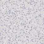 Anti-SETD3 Antibody