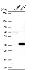 Anti-SETD3 Antibody