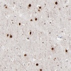 Anti-ZNF3 Antibody