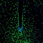 Anti-ZNF3 Antibody