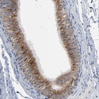 Anti-YIPF6 Antibody