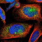 Immunofluorescent staining of human cell line U-2 OS shows localization to vesicles.