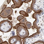 Anti-PDLIM2 Antibody