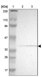 Anti-PDLIM2 Antibody