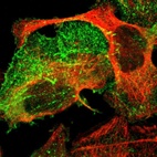 Anti-PDLIM2 Antibody