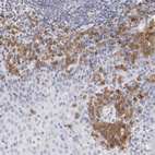 Immunohistochemical staining of human tonsil shows cytoplasmic positivity in a subset of non-germinal center cells.