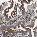 Anti-RARRES1 Antibody