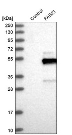 Anti-FCMR Antibody