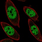 Anti-UBP1 Antibody