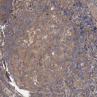 Anti-PITPNM2 Antibody