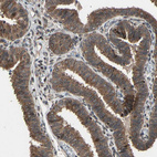 Immunohistochemical staining of human fallopian tube shows moderate cytoplasmic positivity in glandular cells.