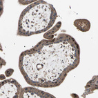 Immunohistochemical staining of human placenta shows moderate cytoplasmic positivity in trophoblastic cells.