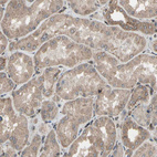 Immunohistochemical staining of human kidney shows weak cytoplasmic positivity in cells in tubules.