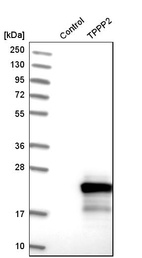 Anti-TPPP2 Antibody