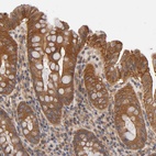 Anti-LAMTOR2 Antibody