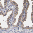 Anti-RBM23 Antibody