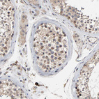 Anti-CCDC175 Antibody