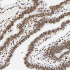 Anti-HOXA6 Antibody