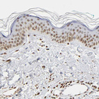 Anti-HOXA6 Antibody