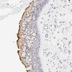 Anti-CYP4B1 Antibody