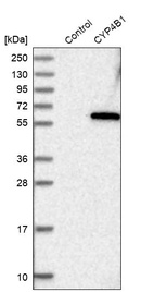 Anti-CYP4B1 Antibody