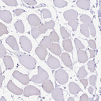 Immunohistochemical staining of human skeletal muscle shows negative cytoplasmic positivity in myocytes as expected.