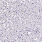 Immunohistochemical staining of human liver shows negative cytoplasmic positivity in hepatocytes.