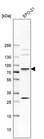 Western blot analysis in human cell line EFO-21.