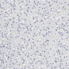 Anti-PDLIM3 Antibody