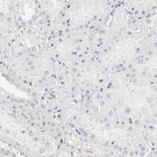 Anti-PDLIM3 Antibody