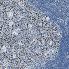 Anti-MCM3 Antibody