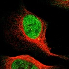 Anti-MCM3 Antibody