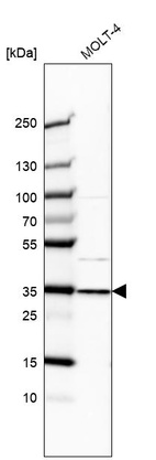 Anti-GTF2E2 Antibody