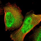 Anti-GTF2E2 Antibody