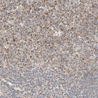 Anti-ZMAT5 Antibody