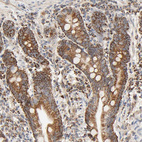 Anti-ZMAT5 Antibody